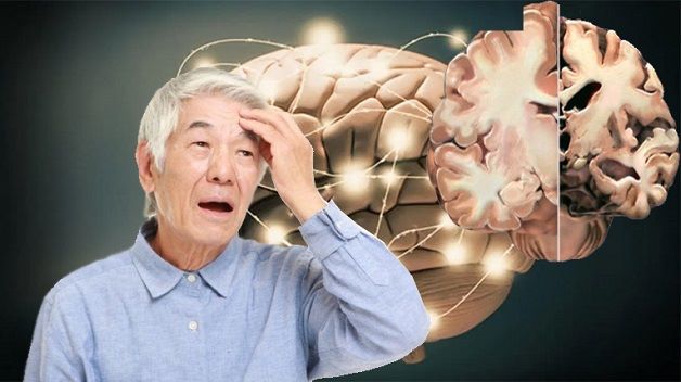 nguoi-gia-thuong-bi-suy-giam-tri-nho1-1642086692680493183806